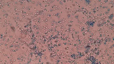 Ketoconazole Shampoo for Hair Loss: What 27 Years of Evidence Actually Show (2026)