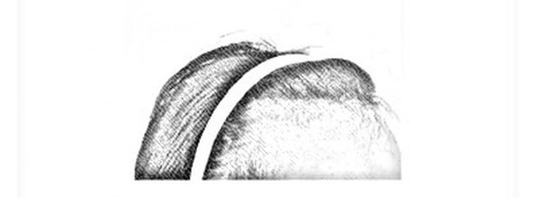 髮際線略為上移，在側邊額角的地方有三角形的小缺角。